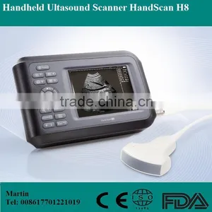 HandScan H8 Portable/palm Handheld Ultrasonic/ Ultrasound Machine Lower Price/medical Equipment thumbnail-1