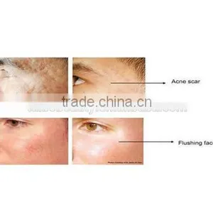 rf Lifting Radio Frequency Skin Tightening Machine Beauty Salon Spa Clinic Equipment thumbnail-6