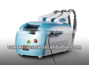 Cavitation Vans 2 for Cellulite Burning and Weight Loss thumbnail-1