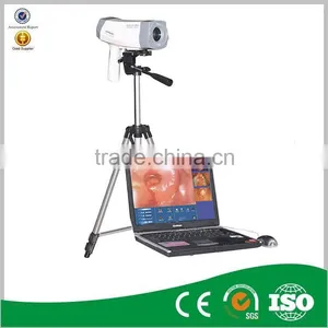 Colposcope/ DIgital Colposcoe /colposcope Camera thumbnail-1