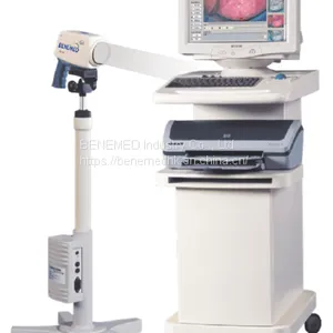 Medical Equipment Digital Video Colposcope for Gynecology thumbnail-1