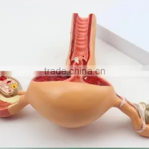 Human Uterus and Ovary Vaginal Pathological Changes Model of Reproductive Department of Gynecology Medical Demonstration Model thumbnail-2