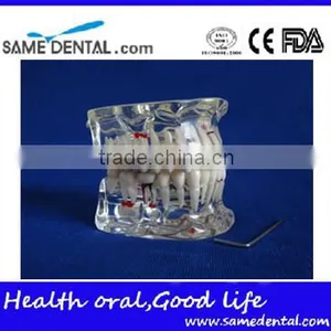 Dental Adult Pathological Dentition Model DEA-48 Teeth Model Teaching Demonstration thumbnail-1