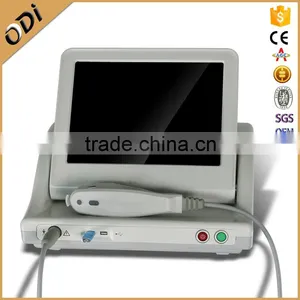 2016 Best Anti-wrinkle HIFU High Frequency Machine For Face Ultrasound Therapy Machine OD-H9 High Frequency Machine For Hair thumbnail-3
