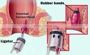 Ligator Bands thumbnail-2