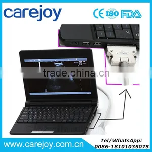 Carejoy CE Approved Laptop Ultrasound Scanner/machine With Convex, Linear Probe/Transducers and Sony Printer thumbnail-1