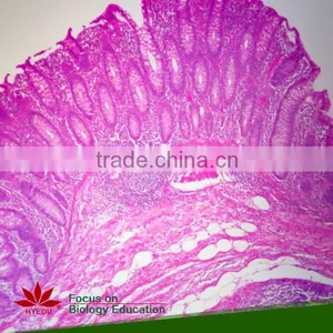 75pcs Anatomy Prepared Slides Set for School Teaching thumbnail-1