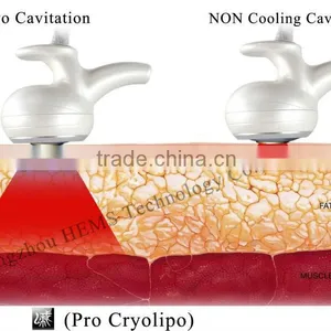 Hot Selling COOLIPO V7 Cavitation RF Cool Loss Weight Machine thumbnail-5