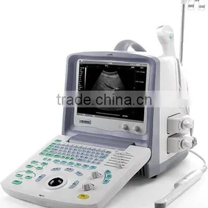 FM-2000 Portable Ultrasound Machine for Sale thumbnail-2
