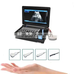 Light Weight PC Platform 10.4 Inch Laptop Ultrasound Scanner With 3.5Mhz Convex Probe Multi-frequency thumbnail-1