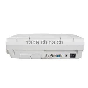 China Medical Human Use Ultrasound Scanner Portable Laptop thumbnail-5
