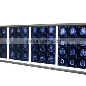 LED Brightness Adjustable x Ray Equipment for Sale thumbnail-1