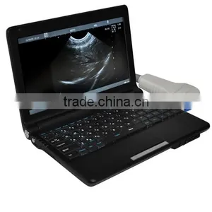 3D Workstaion 10 Inch Laptop Ultrasound Scanner RUS-9000F With 3.5Mhz Convex Probe by CE ISO Approved thumbnail-2