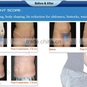 CE / FDA Approved High Effective HIFU Shape Body Slimming Machine Far Infrared Slimming Pressotherapy Machine thumbnail-6