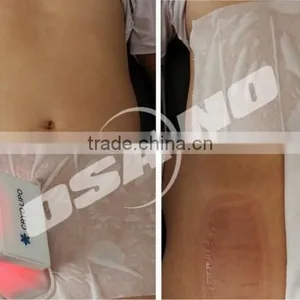 New Portable Slimming Machine Cryotherapy for Weight Loss thumbnail-5