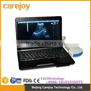 CE/ISO Certificate Laptop Ultrasound Machine /scanner for Scan With 3D Image thumbnail-1