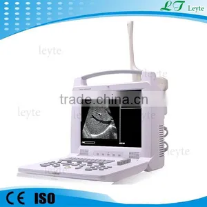 LT3018I CE Medical Digital Laptop Scanner Ultrasound Machine for Sale thumbnail-1