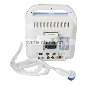 Portable Full Digital Color Doppler Ultrasound Scanner Diagnostic System 2 Probe With Convex Probe and Transvaginal Probe thumbnail-3
