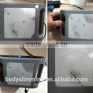 Professional Fat Freezing Mini Cryolipolysis For Home Use thumbnail-4