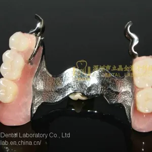 Dental Precision Attachment, Dental Attachment, Dental Denture, Laboratoire Dentaire, Dentallabor, Laboratorio Dental, Dental Laboratory, Shenzhen LJ Dental Lab China thumbnail-5