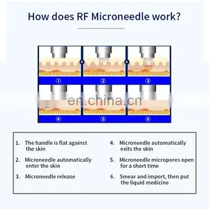 Fractional Gold RF Microneedle Skin Therapy Beauty Instrument Anti-aging Face Lift Shrink Pores Repair Skin Body Care Machine thumbnail-2