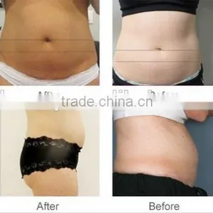 Improve Blood Circulation Eye Lines Removal Hifu Shape Cool Sculpting Slimming Machine High Focused Ultrasonic Liposonic Ultrasound Slimming Machine thumbnail-6