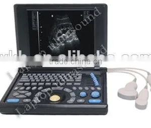 CE Approved Notebook Ultrasound Scanner With 3.5Mhz Multi-frequency Convex Probe RUS-9000E2 thumbnail-2