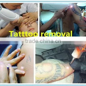 2000mj Strong Power Factory Direct Q 800mj Switch Nd Yag Laser Tattoo Removal Machine Permanent Tattoo Removal thumbnail-6