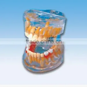 Transparent Baby Teeth Model thumbnail-1