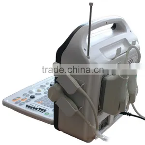 2016 New 3D 4D Color Doppler Ultrasound Machine With CFM, PW, CDE, CCD, HPRF Modes Quality Choice Supplier's Ch thumbnail-2
