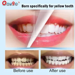 Alcohol Free Teeth Whitening Strips thumbnail-2
