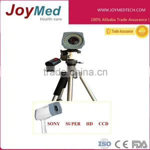 Portable Digital Vaginal Colpscope With Tripod thumbnail-1