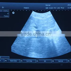 Portable PC Platform 3D Ultrasound Scanner Diagnosis of Abdomen Cardiac Gynecology Obstetrics Thyroid Gland Small Organs Urology thumbnail-5
