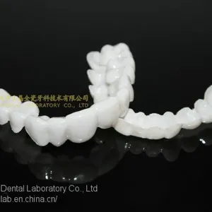 Dental PETG Clip on Veneers, Snap-on-veneers, Smile Veneers, Laboratoire Dentaire, Dentallabor, Laboratorio Dental, Dental Laboratory, Shenzhen LJ Dental Lab China thumbnail-3
