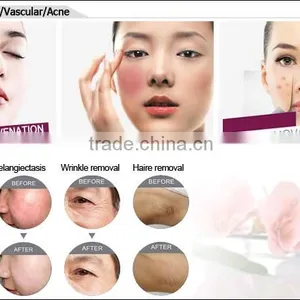 Ce Approved IPL for Face Care Beauty Machine /7 Filters thumbnail-4