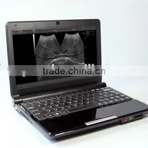 Portable Black and White Ultrasound ISO CE FDA thumbnail-1