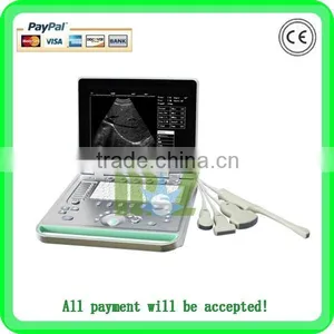 MSLPU25A HOT SALES Digital Best Medical Portable China Portable Ultrasound Machine Price thumbnail-1