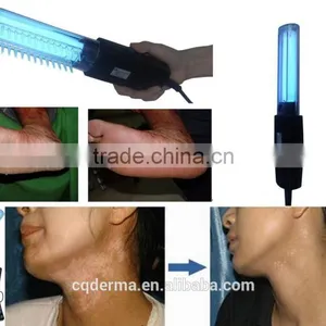 Effective UV Vitiligo Treatment -uv Phototherapy Lamp for Vitiligo Curing thumbnail-3