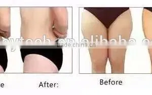 Weight Loss Hifu Ultrasound Expression Lines Removal Korea Slimming Machine FU-18S 0.1-2J thumbnail-3