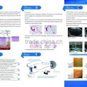 Most Advanced Non Surgical Lipo Cavitation Fat Removal Machine for Beauty Salon Use thumbnail-6
