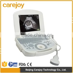 Electric Ultrasonic Equipment High-frequency Beam-former Cheap Ultrasound Machine Price thumbnail-1