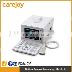 Factory Price!!CE Approved Notebook/Portable Ultrasound Scanner With 3.5Mhz Multi-frequency Convex Probe RUS-6000D thumbnail-1