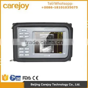 New Palm Ultrasound Machine / Scanner With Convex Probe With CE/ISO Certification thumbnail-1