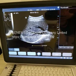 Ultraslim Notebook Type Black and White Ultrasound Scanner Devices thumbnail-3