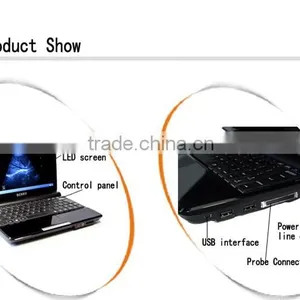 Full Digital Hot Sale B-14 Medical B&W Portable Ultrasound Machine thumbnail-5