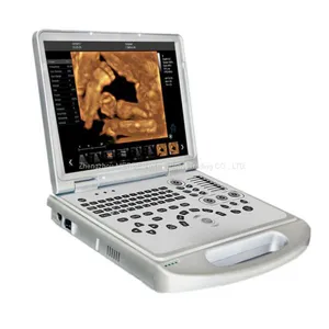 Portable 4D Color Doppler Ultrasound Scanner thumbnail-3