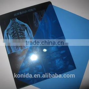 Agfa Film Dt2b 2015 New Product Cheap Dry Film Agfa X-ray Film thumbnail-3
