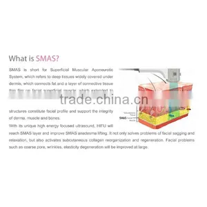 Portable High Frequency Face Machine Professional Face Lifting Machine Prices Hifu Fda Approval 0.1-2J thumbnail-2