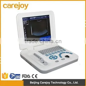 Laptop Ultrasound Machine With 3.5 Mhz Convex Probe by CE/ISO Approved thumbnail-1
