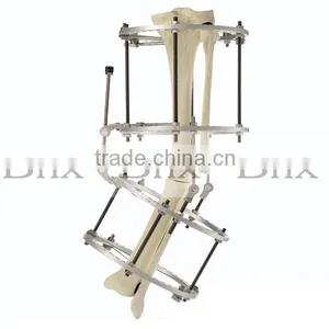 Circular External Fixator With Multiple Rings According to the Demands thumbnail-1